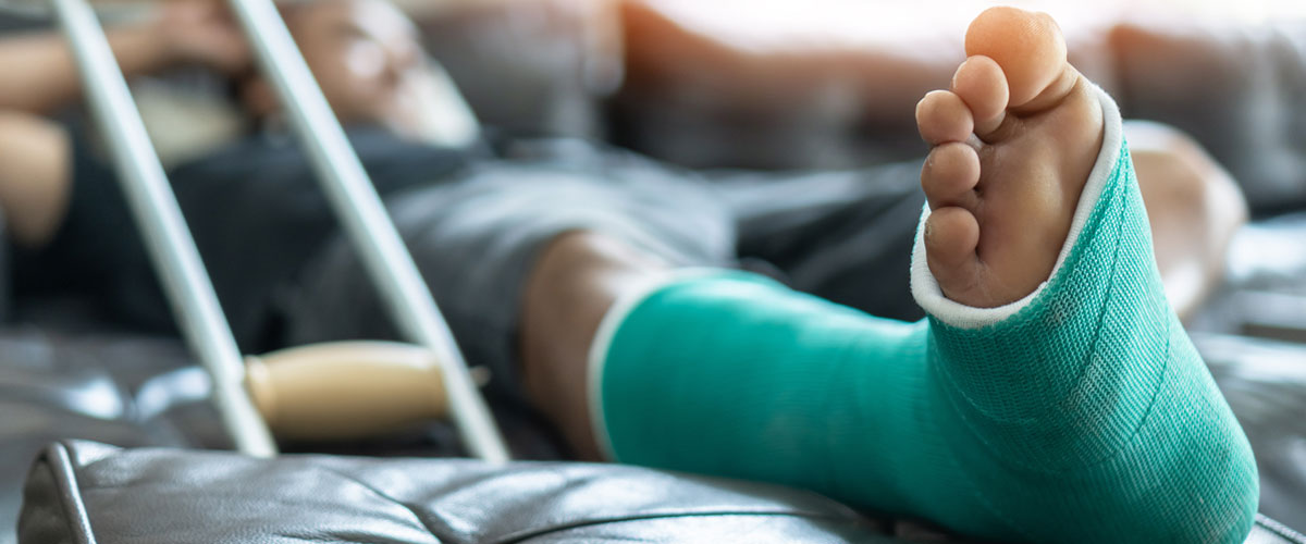 A single male lying down at home with his leg stretched out wearing a green splint and cast after a bone fracture and foot surgery.