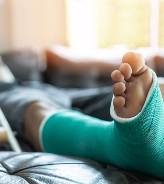 A single male lying down at home with his leg stretched out wearing a green splint and cast after a bone fracture and foot surgery.